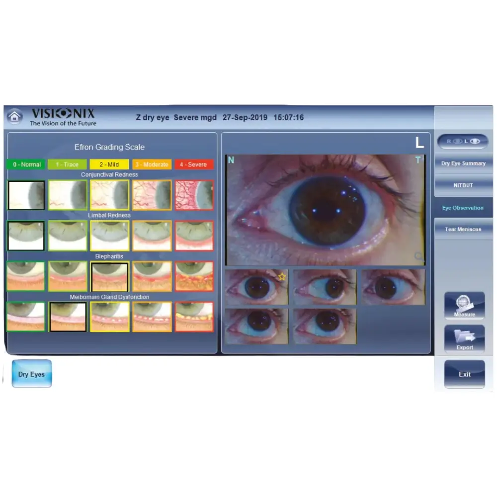 Комбиниран уред Visionix VX120 Dry Eye